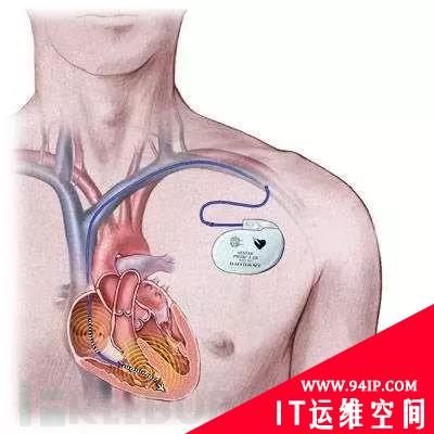 纯技术上来说，《看门狗》里的各种骇客技术有可能实现吗？